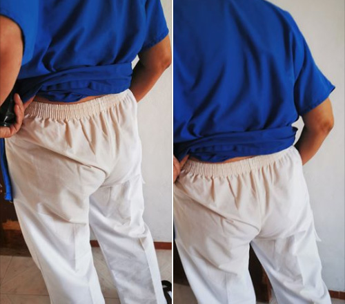 Agreden a personal médico en Yucatán por temor a COVID-19