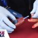 Puebla, segundo lugar en detección de diabetes mellitus: Salud