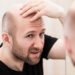 ¿Por qué tomar refresco puede provocar calvicie en hombres? Esto explica un estudio