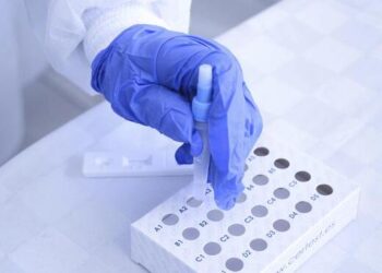 Registra Puebla 33 casos activos de COVID-19: Salud