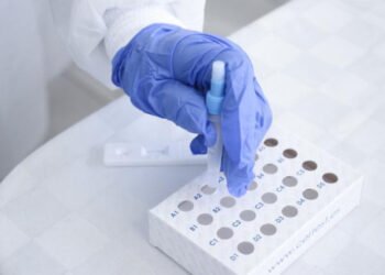 Permanecen nueve personas hospitalizadas por COVID-19: Salud