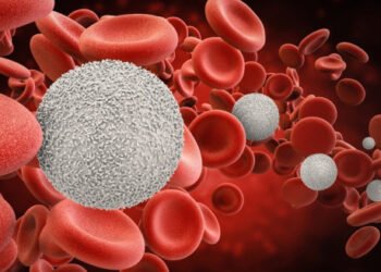 Linfoma, enfermedad neoplásica que se presenta con más frecuencia en hombres