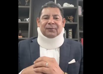 Por lesión el Gobernador Alejandro Armenta reducirá eventos presenciales